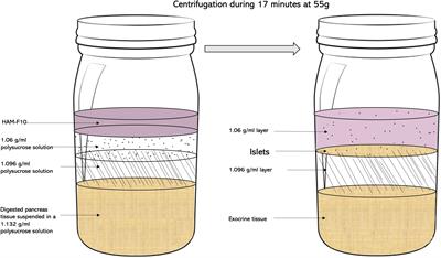 Continuous vs. discontinuous purification of isolated human islets: functional and morphological comparison